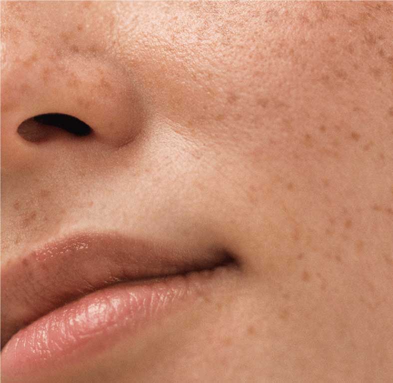 Mejorar las manchas e imperfecciones - Cosmética Vicorva
