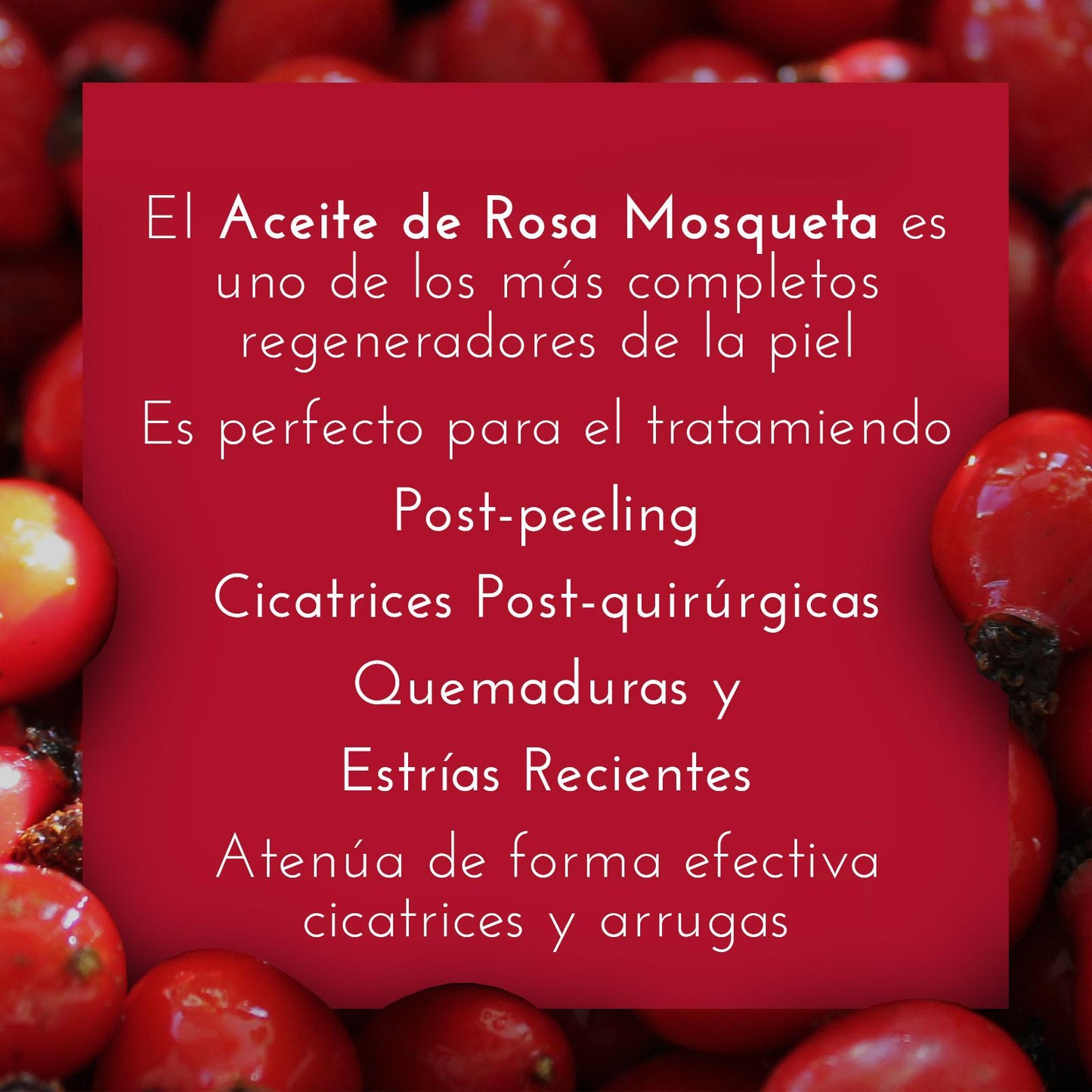 Aceite Rosa Mosqueta 100% Puro - 20 ml - Cosmética Vicorva