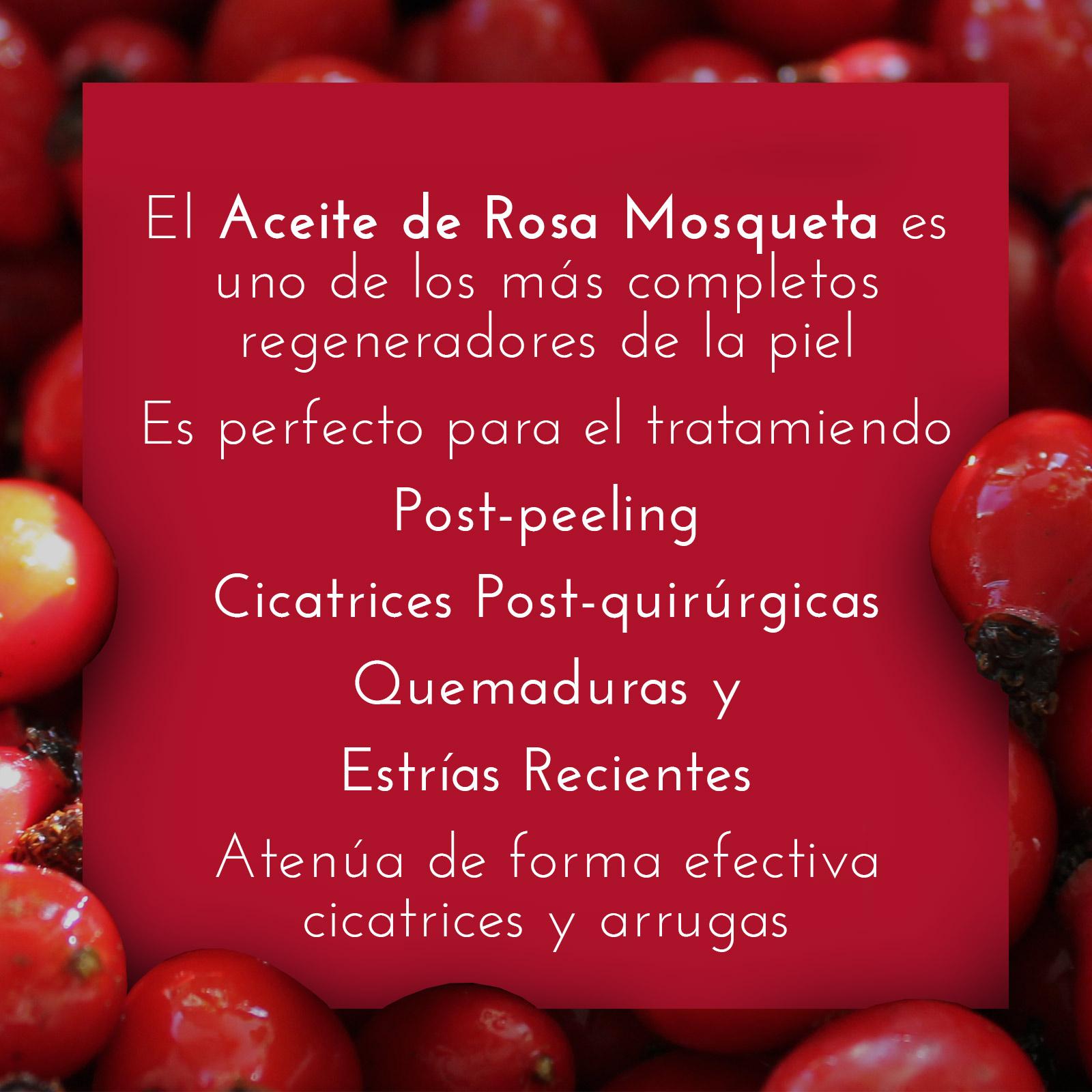 Aceite Rosa Mosqueta 100% Puro - 20 ml - Cosmética Vicorva